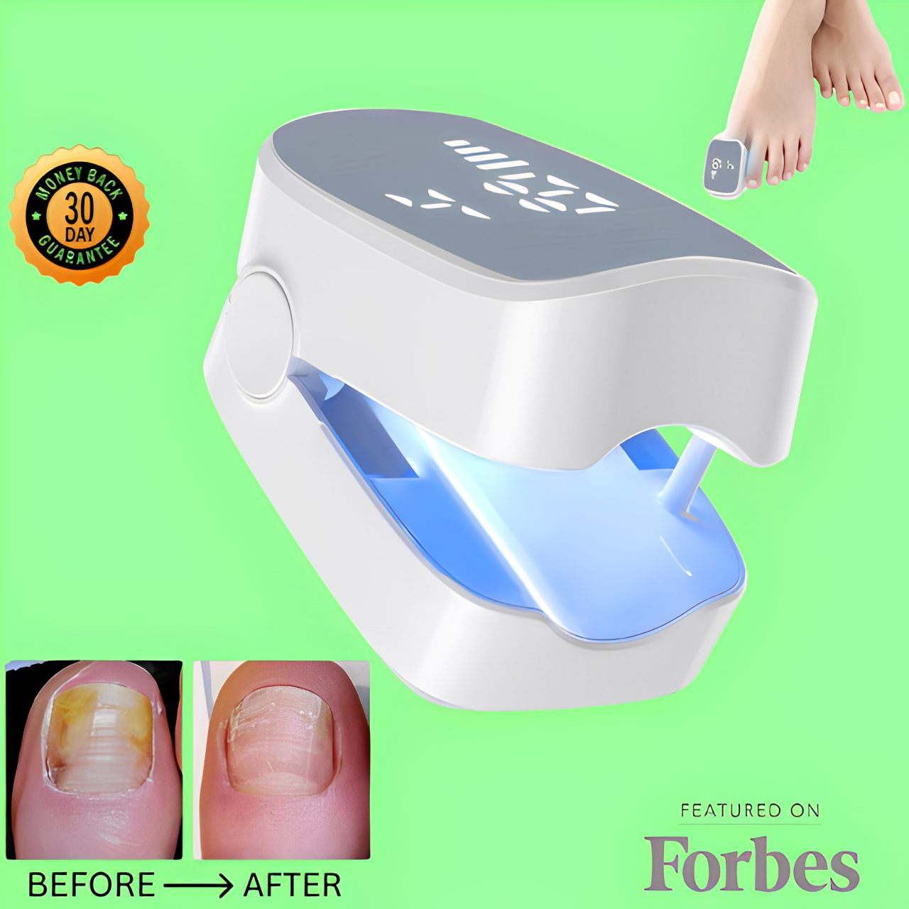 Rosamua ™ - Nail Fungus Laser Device