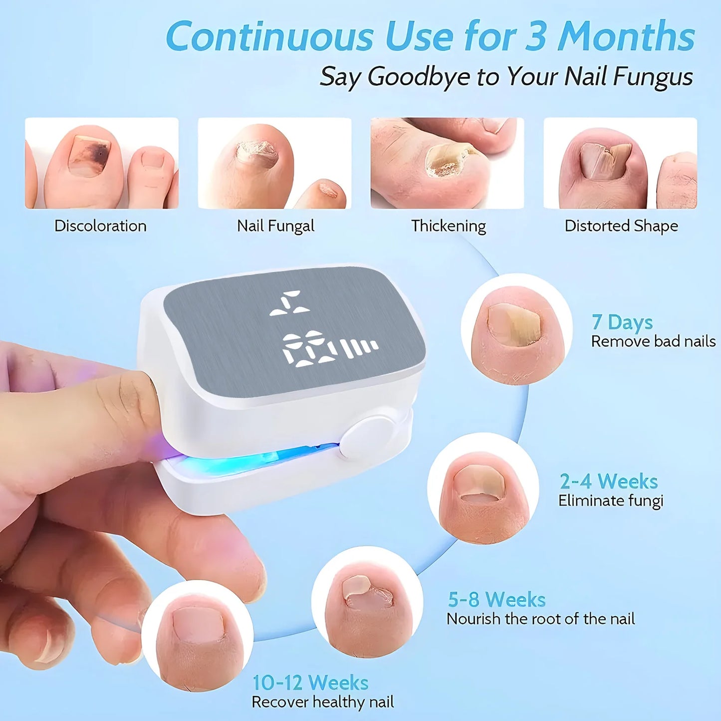 Rosamua ™ - Nail Fungus Laser Device