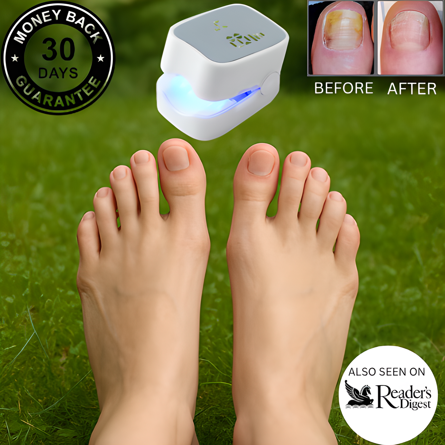 NailCure Pro™ - Nail Fungus Laser Device